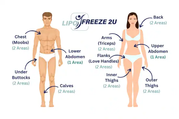 Areas you can have fat freezing treatment Kilburn