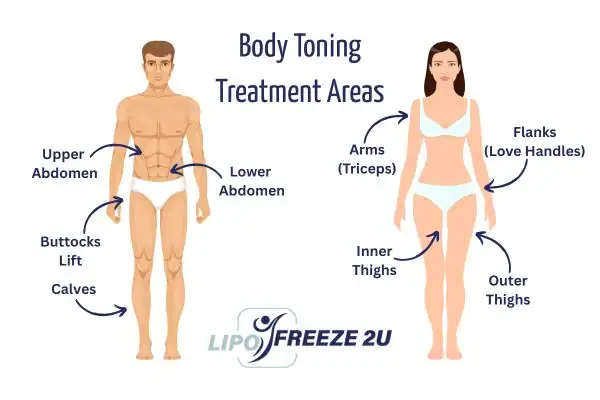 Graphic showing where you can have Body toning Treatment Kilburn on your body