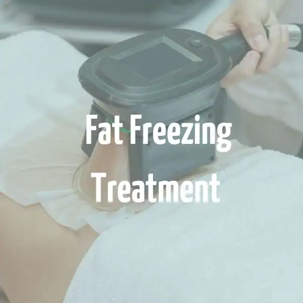 fat freezing treatment Kilburn