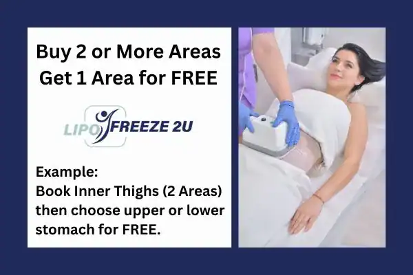 fat freezing prices Kilburn