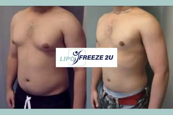 How Long Does It Take to See Results Kilburn?