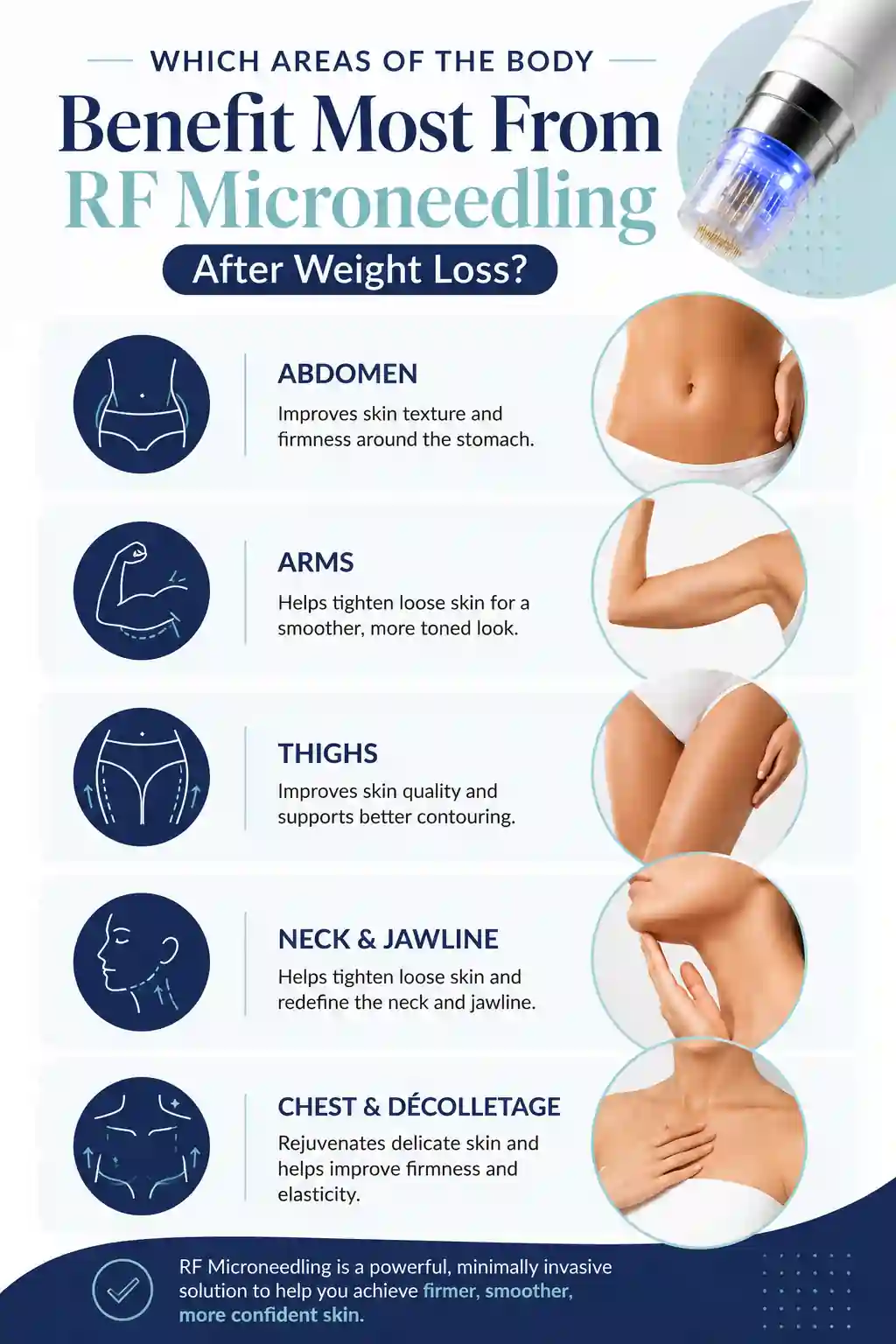 Which Areas of the Body Benefit Most From RF Microneedling After Weight Loss Kilburn